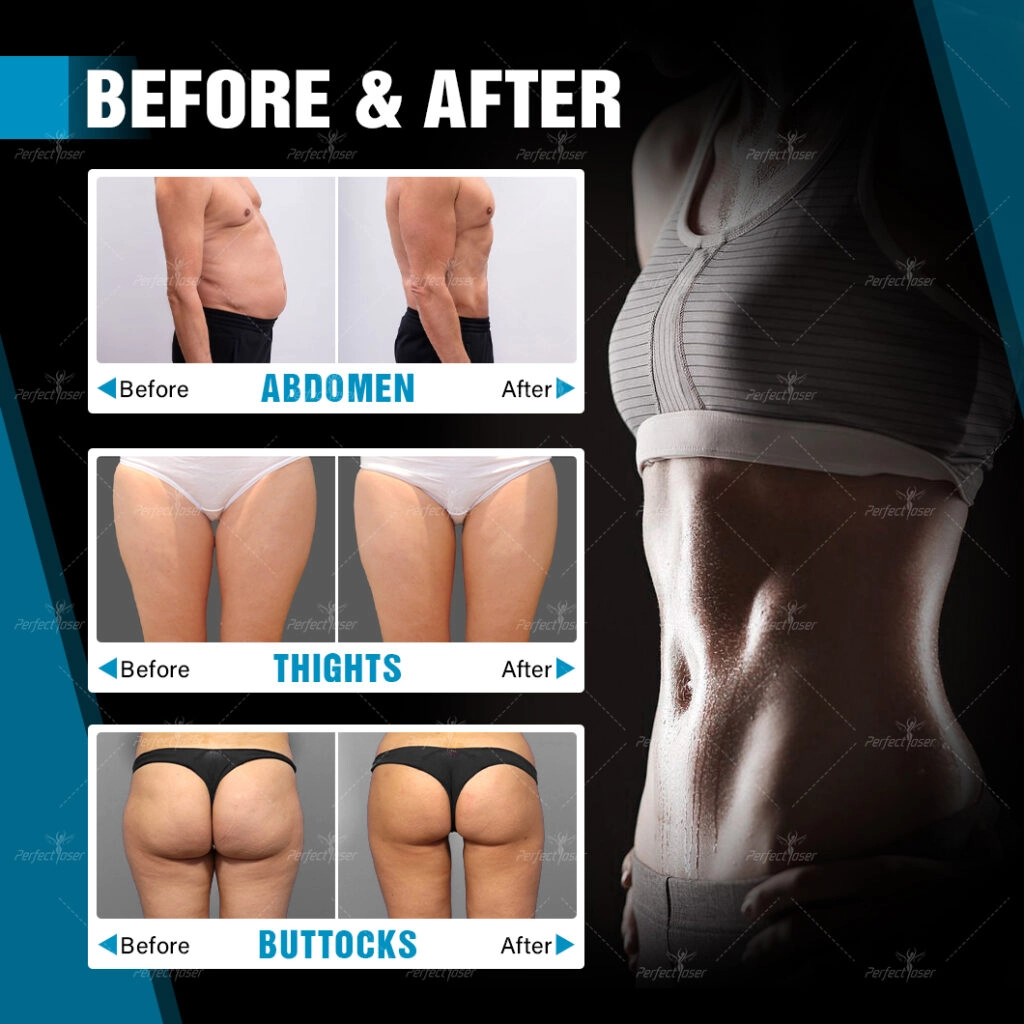 EMS Sculpting Machine(2)