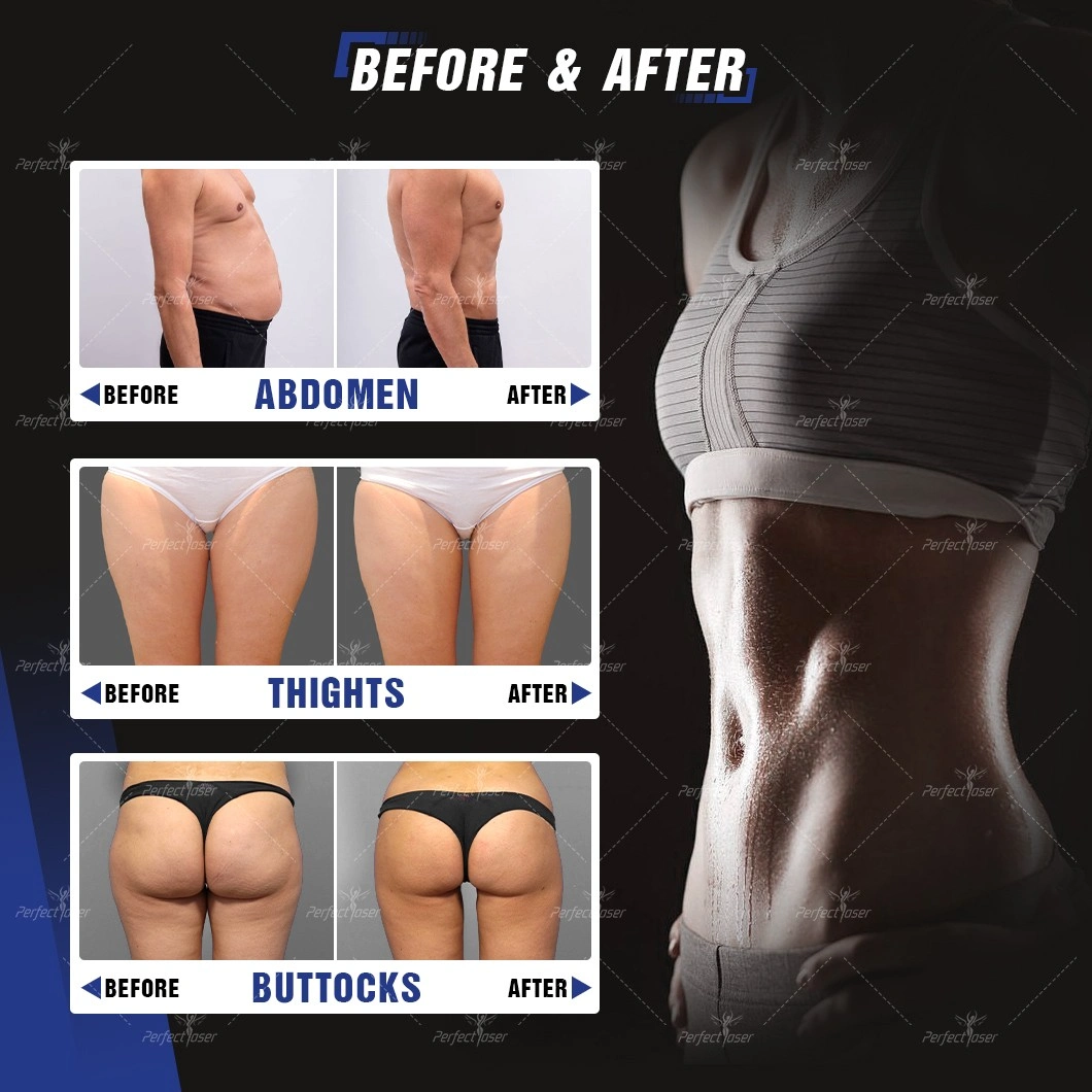 body Slimming solution