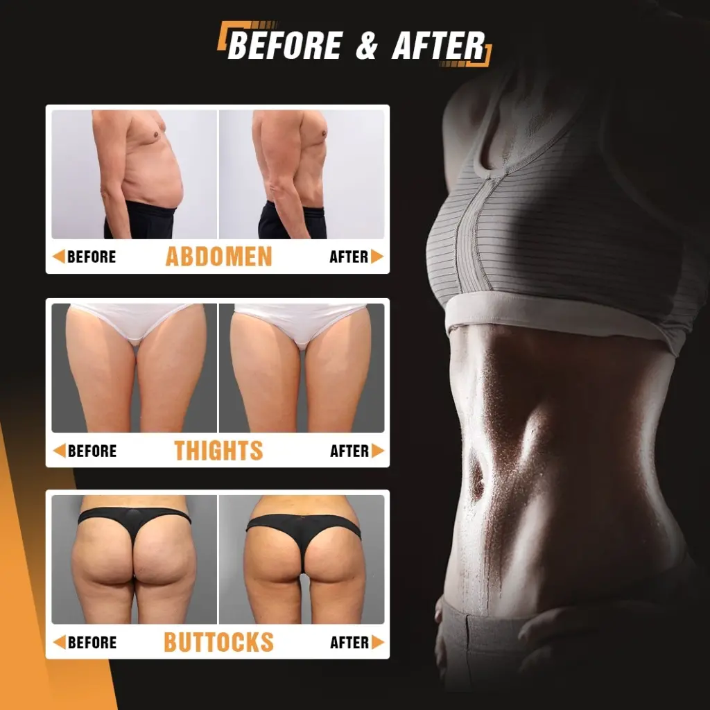 EMS Sculpting Machine(2)