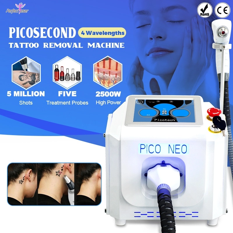 picosecond laser tattoo removal(1)