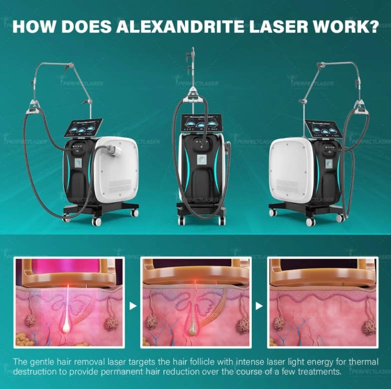 Alexandrite Laser Hair Removal Machine.webp