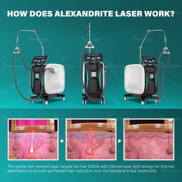 Alexandrite Laser Hair Removal Machine(4)